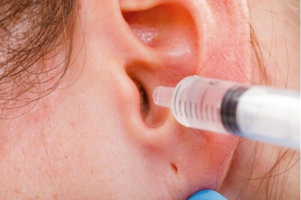 Làm sạch tai bằng dung dịch nhỏ tai giúp giảm viêm tai giữa giai đoạn vỡ mủ